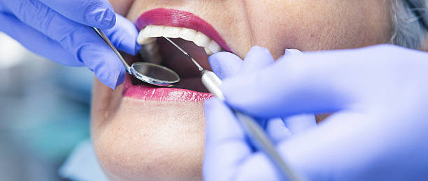 Best Dentist for Tooth Abscess  in Holiday Heights, NJ